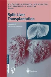 Book cover of Split liver transplantation by X. Rogiers