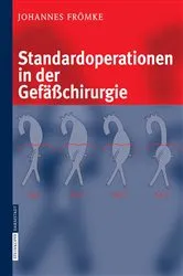 Book cover of Standardoperationen in der Gefäßchirurgie by Johannes Frömke