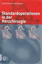 Book cover of Standardoperationen in der Herzchirurgie by Johannes Frömke