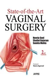 Book cover of State-of-the-Art (2nd ed.) by Goel Neerja