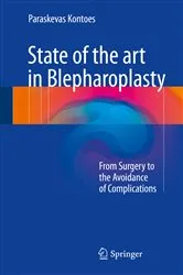 Book cover of State of the art in Blepharoplasty by Paraskevas Kontoes