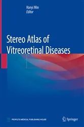 Book cover of Stereo Atlas of Vitreoretinal Diseases by Hanyi Min
