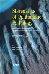 Book cover of Stereoatlas of Ophthalmic Pathology by P. Meyer