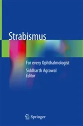 Book cover of Strabismus by Siddharth Agrawal