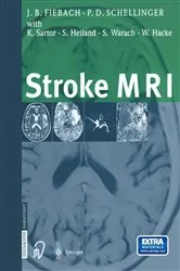 Book cover of Stroke MRI by Jochen Fiebach
