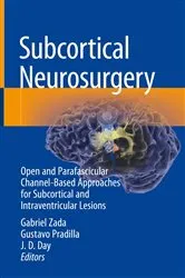 Book cover of Subcortical Neurosurgery by Unknown