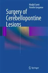 Book cover of Surgery of Cerebellopontine Lesions by Madjid Samii