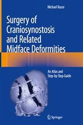 Book cover of Surgery of Craniosynostosis and Related Midface Deformities by Michael Rasse