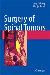 Book cover of Surgery of Spinal Tumors by Jörg Klekamp