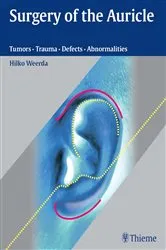 Book cover of Surgery of the Auricle by Hilko Weerda