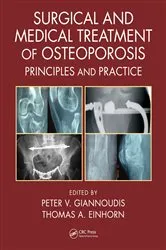 Book cover of Surgical and Medical Treatment of Osteoporosis by Peter V. Giannoudis