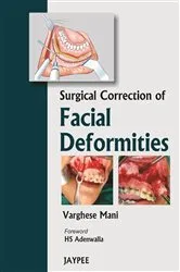Book cover of Surgical Correction Of Facial Deformities by Varghese Mani