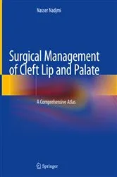 Book cover of Surgical Management of Cleft Lip and Palate by Nasser Nadjmi