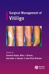 Book cover of Surgical Management of Vitiligo by Somesh Gupta