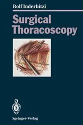 Book cover of Surgical Thoracoscopy by Rolf Gilbert Carl Inderbitzi
