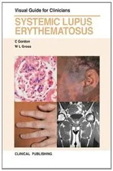 Book cover of Systemic Lupus Erythematosus by C. Gordon