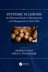 Book cover of Systemic Sclerosis by Arun C Inamadar