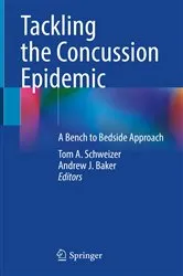 Book cover of Tackling the Concussion Epidemic by Tom A. Schweizer