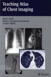 Book cover of Teaching Atlas of Chest Imaging by Mark S. Parker