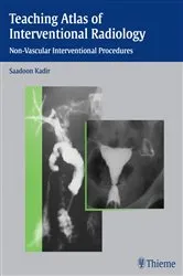 Book cover of Teaching Atlas of Interventional Radiology by Unknown