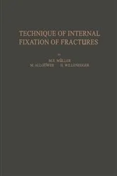 Book cover of Technique of Internal Fixation of Fractures by Unknown