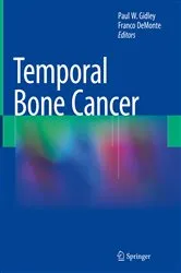 Book cover of Temporal Bone Cancer by Paul W. Gidley