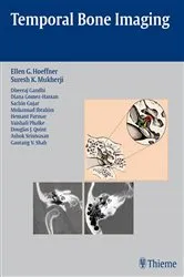 Book cover of Temporal Bone Imaging by Ellen G. Hoeffner