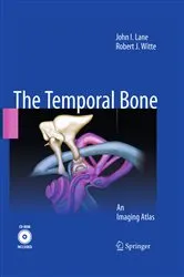 Book cover of Temporal Bone by John I. Lane