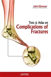 Book cover of Text And Atlas On Complications Of Fractures by Ebnezar John