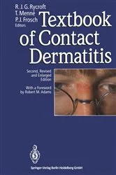 Book cover of Textbook of Contact Dermatitis (2nd ed.) by Richard J.G. Rycroft