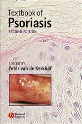 Book cover of Textbook of Psoriasis (2nd ed.) by Peter C. M. van de Kerkhof