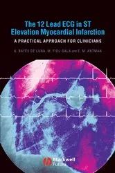 Book cover of The 12 Lead ECG in ST Elevation Myocardial Infarction by Antoni Bayés de Luna
