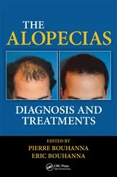 Book cover of The Alopecias by Pierre Bouhanna