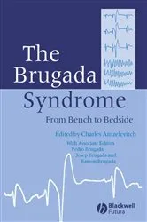 Book cover of The Brugada Syndrome by Charles Antzelevitch