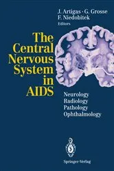 Book cover of The Central Nervous System in AIDS by Juan Artigas