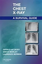 Book cover of The Chest X-Ray: A Survival Guide by de Lacey MA, FRCR, Gerald