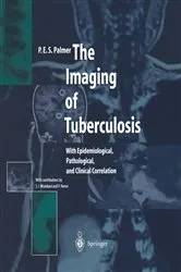 Book cover of The Imaging of Tuberculosis by P.E.S. Palmer