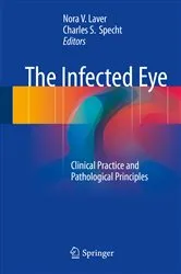 Book cover of The Infected Eye by Nora V. Laver