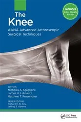 Book cover of The Knee by Nicholas Sgaglione
