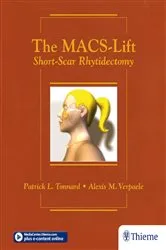 Book cover of The MACS-Lift by Unknown