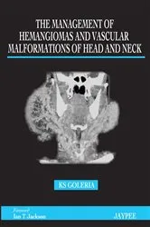 Book cover of The Management of Hemangiomas and Vascular Malformations of Head and Neck by K. S. Goleria