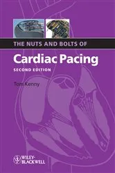 Book cover of The Nuts and Bolts of Cardiac Pacing (2nd ed.) by Tom Kenny