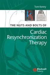 Book cover of The Nuts and Bolts of Cardiac Resynchronization Therapy by Tom Kenny