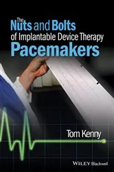 Book cover of The Nuts and Bolts of Implantable Device Therapy by Tom Kenny