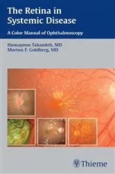 Book cover of The Retina in Systemic Disease by Homayoun Tabandeh