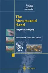 Book cover of The Rheumatoid Hand by G. Garlaschi