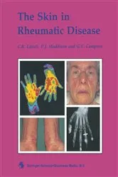 Book cover of The Skin in Rheumatic Disease by C. R. Lovell