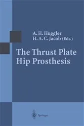 Book cover of The Thrust Plate Hip Prosthesis by A.H. Huggler