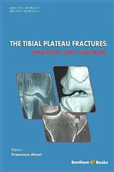 Book cover of The Tibial Plateu Fractures: Diagnosis and Treatment by Francesco Atzori