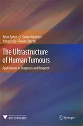 Book cover of The Ultrastructure of Human Tumours by Brian Eyden